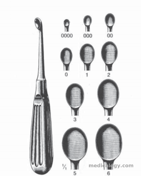 harga Dimeda Wound Treatment Set Large VOLKMANN Bone Curette Fig.1