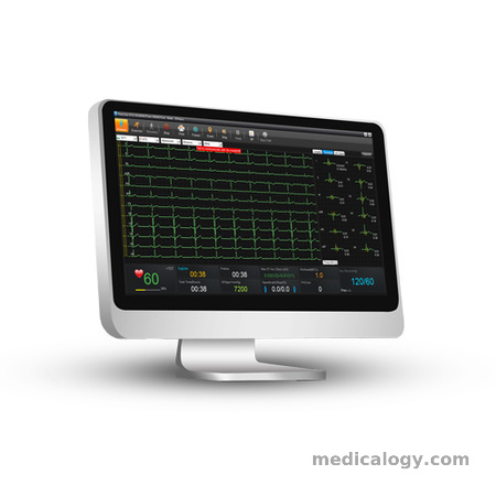 beli Edan ECG SE 1515 (PC ECG)