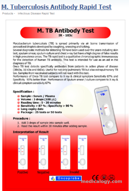 jual Oncoprobe Rapid Test Tuberculosis Antibody 25 Card/Box