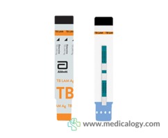 Rapid Test Determine TB LAM Ag SD Diagnostic 